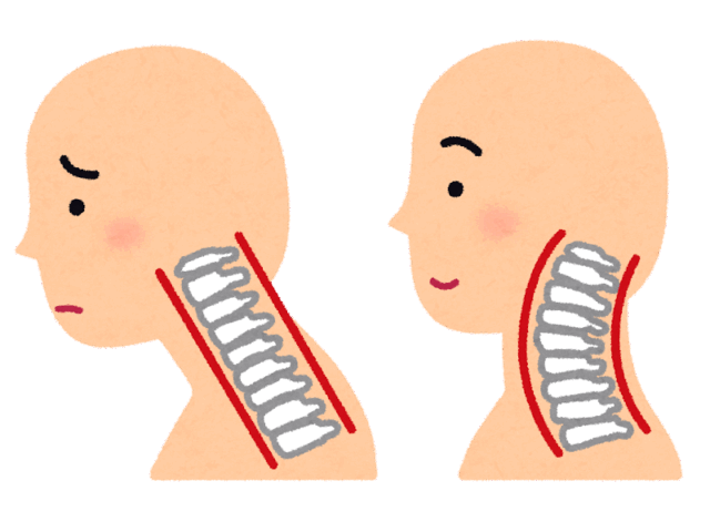 ストレートネックでお悩みの方へ  〜整体・自宅での予防法をしらかわ接骨院が解説〜